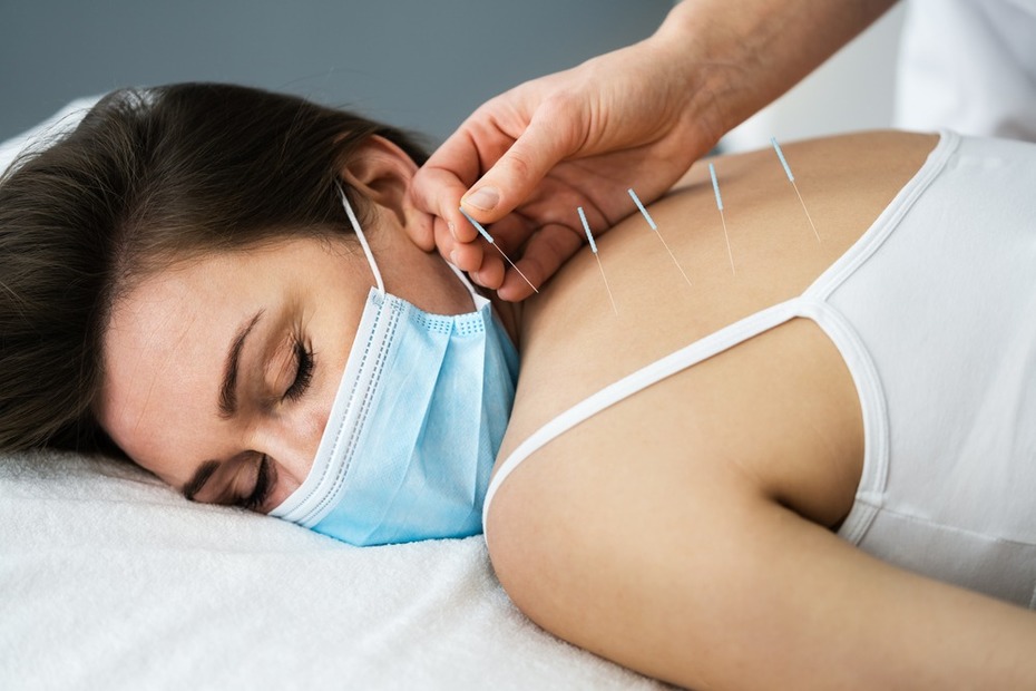 Get Best Dry Needling Treatment Dubai - Pain Relief & Muscle Recovery - Pure Chiro Dubai